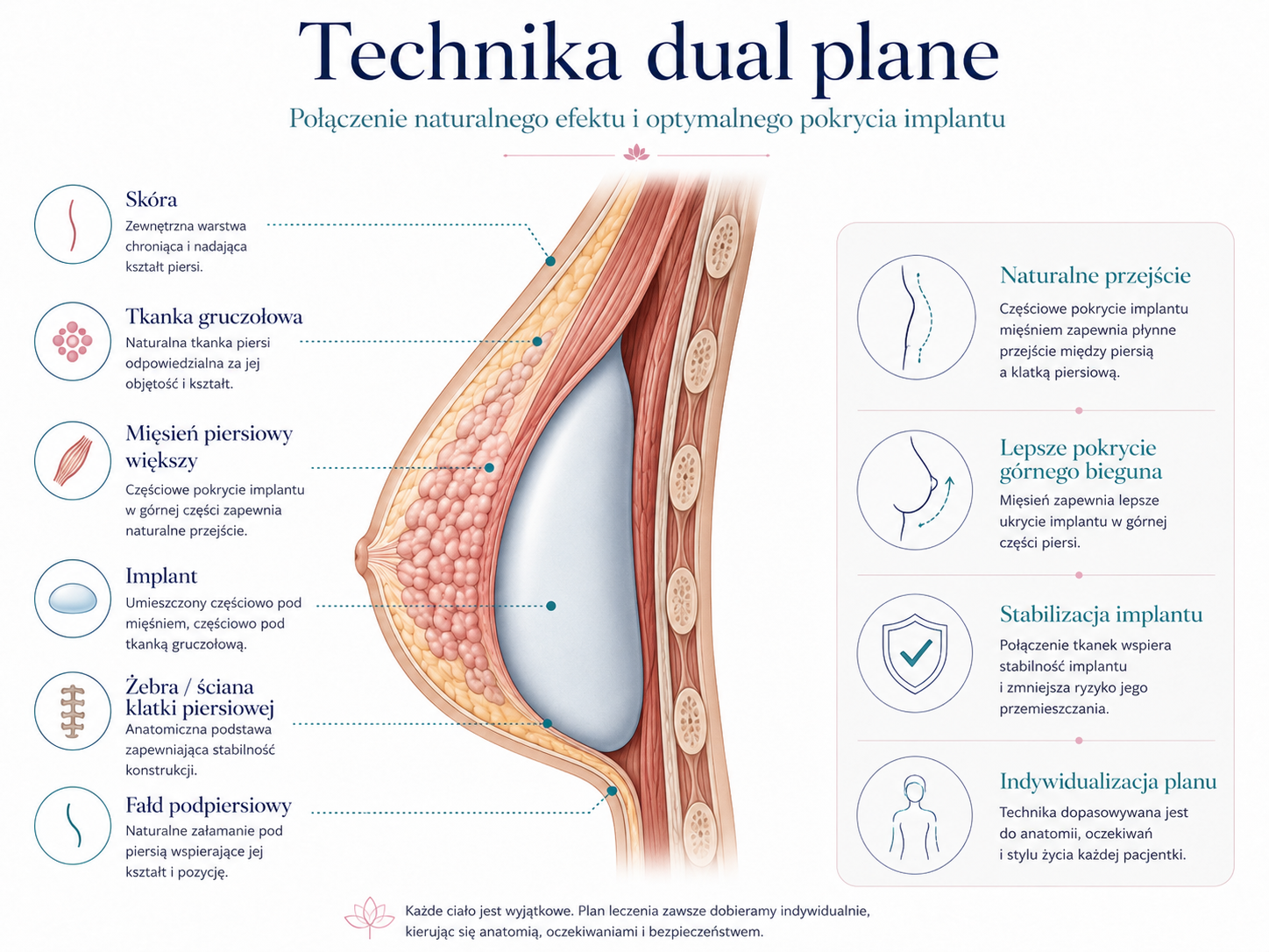 Medyczna ilustracja warstw anatomicznych w technice częściowego pokrycia mięśniem